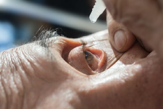 Dry Eye Treatment Philadelphia